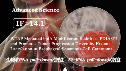 Huang T. et al: WTAP Mediated m6A Modification Stabilizes PDIA3P1 and Promotes Tumor Progression Driven by Histone Lactylation in Esophageal Squamous Cell Carcinoma.